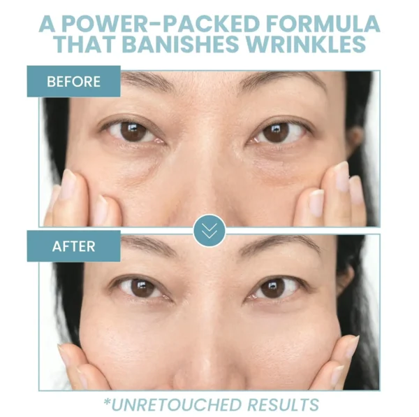 Age-Defying Eye Gel - Hydrating Under Eye Cream for Circles, Wrinkles