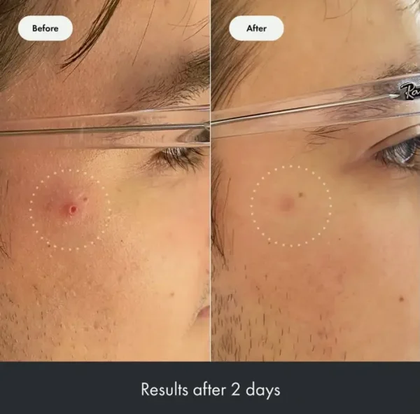 Heroic Cosmetics Rescue Balm - Intensive Calming on Skin Care (0.5 fluid).