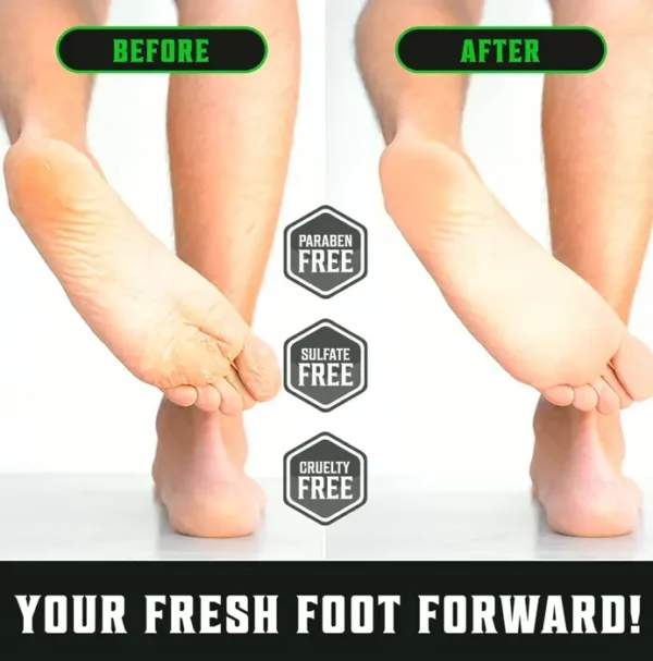 Tea Tree Feet Balm for Cracked Feet with Mint (8oz)
