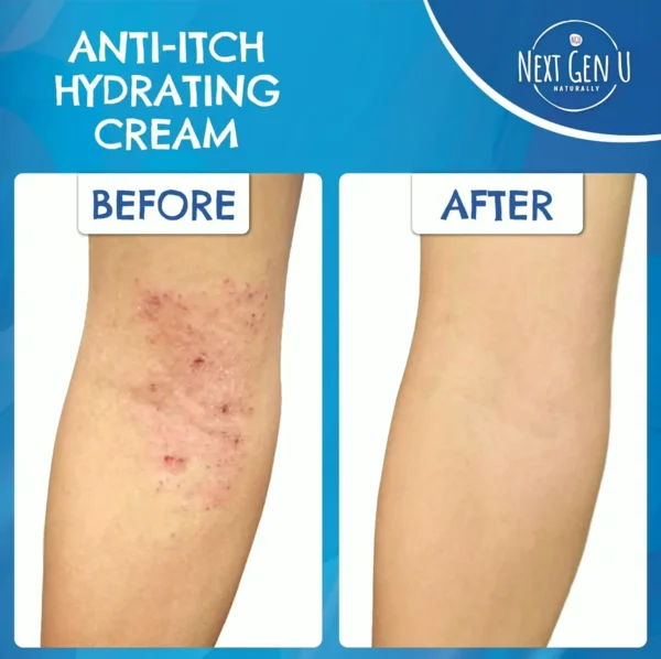 Relieving Relief Lotion with Oat Extract | (8.5 oz)