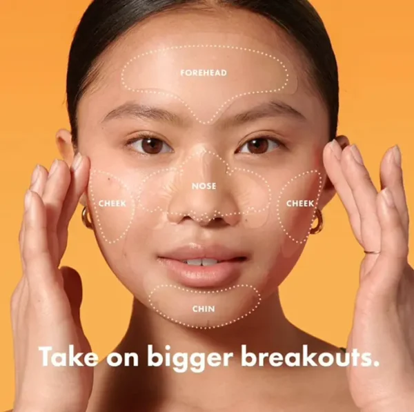 Hero Patch Face Hydrocolloid Mask XL Acne Patches