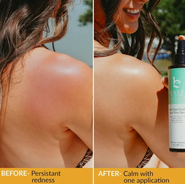 Cooling After Sun Aloe Vera Spray - Organic & Fast Absorbing