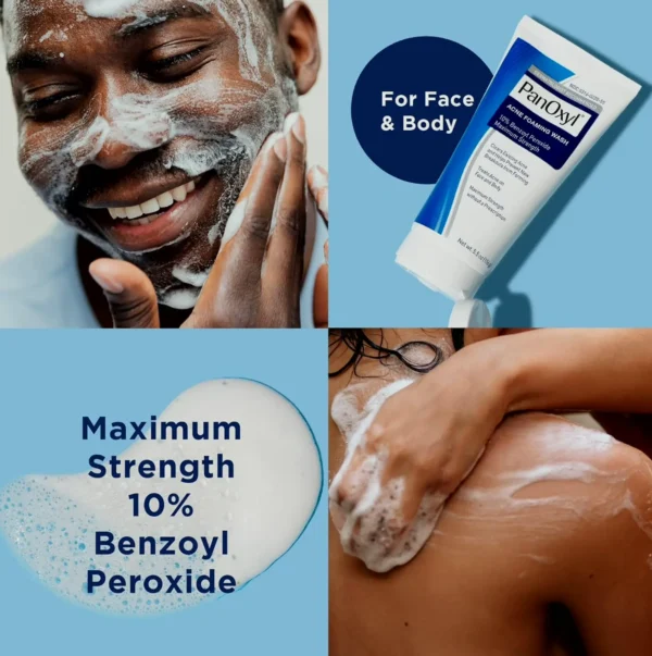 PanOxyl Pimple Wash BP 10% Strength, 5.5 Oz