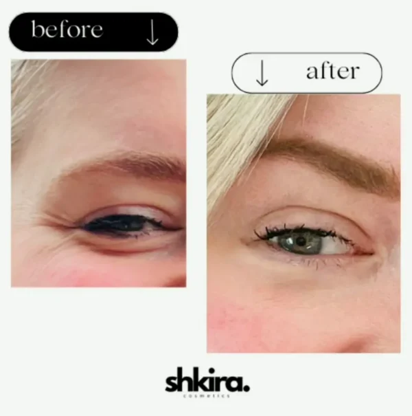 Coffee Under-Eye Serum | Decreases Swelling & Eye Bags