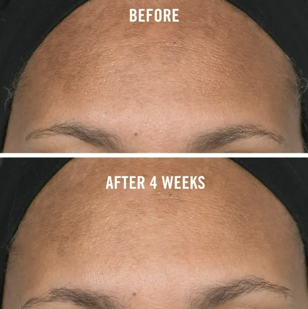 Complexion Brightening Treatment - Spot Reducer