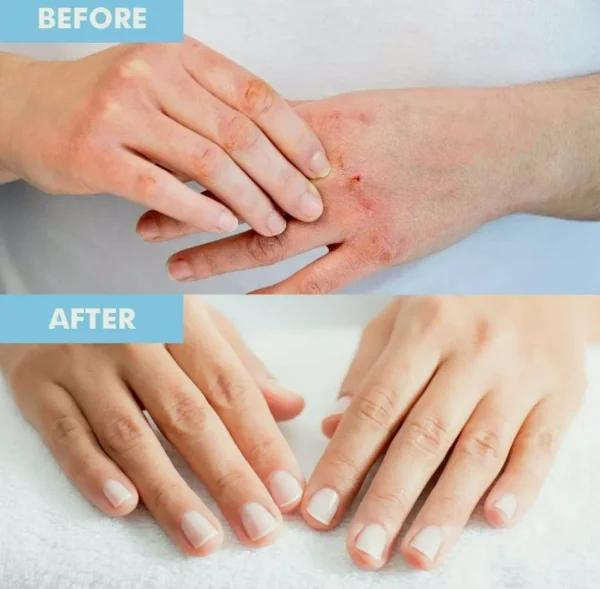 Premium Manual and Feet Coverings Pack | Moisturizing Handwear & Socks